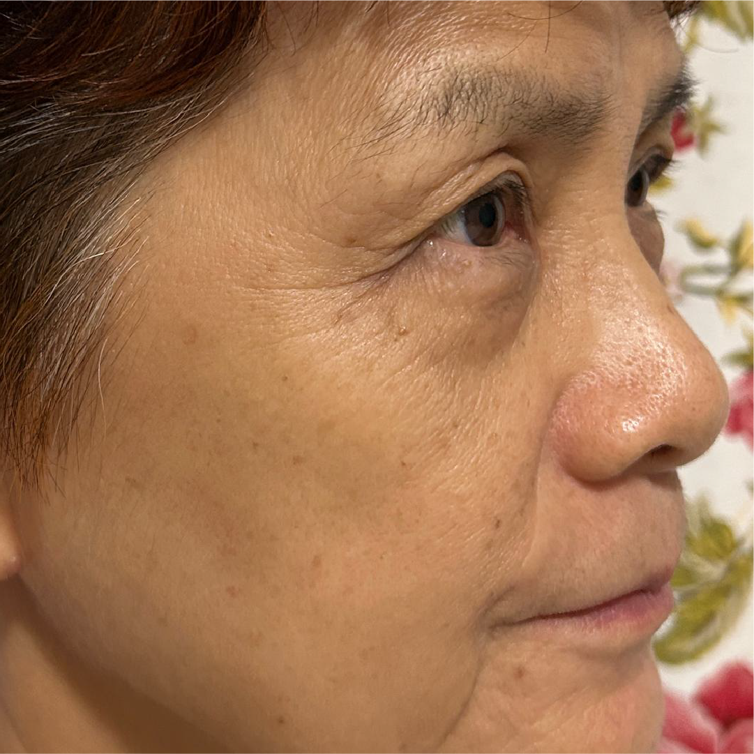 Ms Thean before using argan oil
