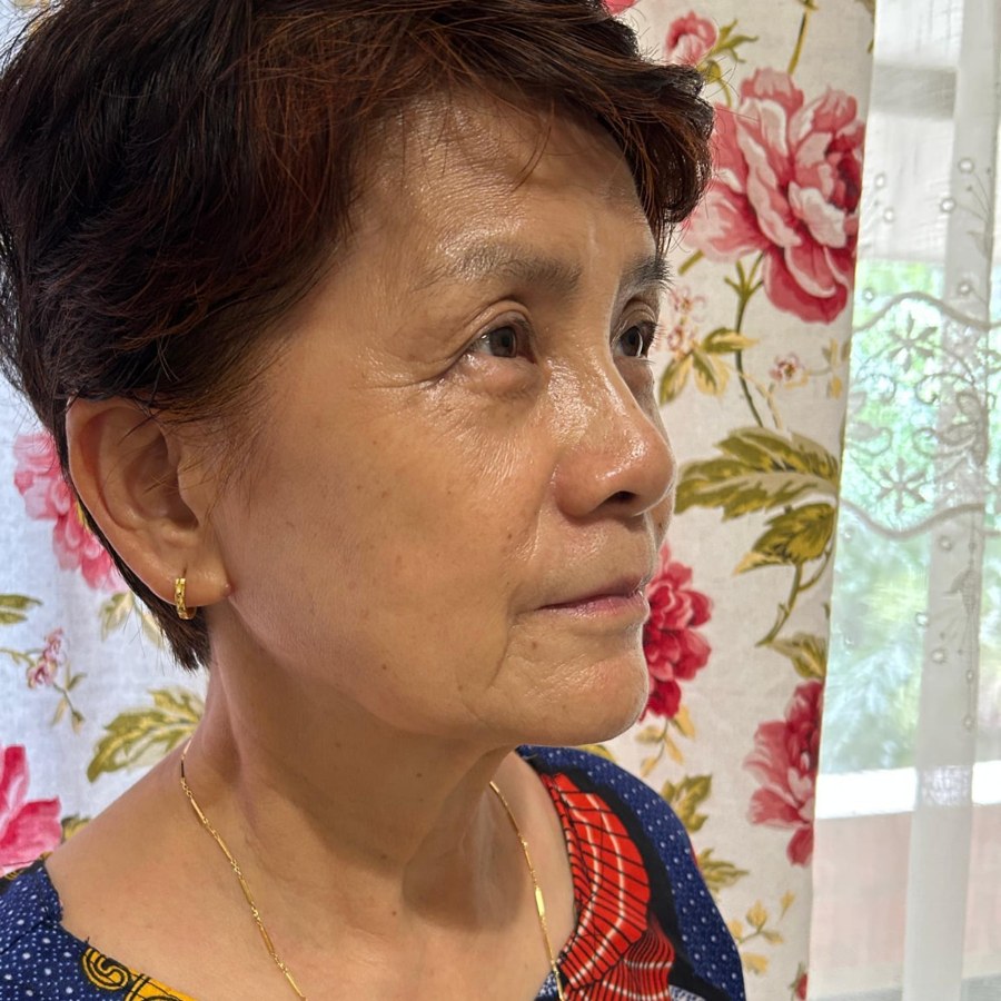 Ms Eng's face before use, with visible crow's feet and fine lines