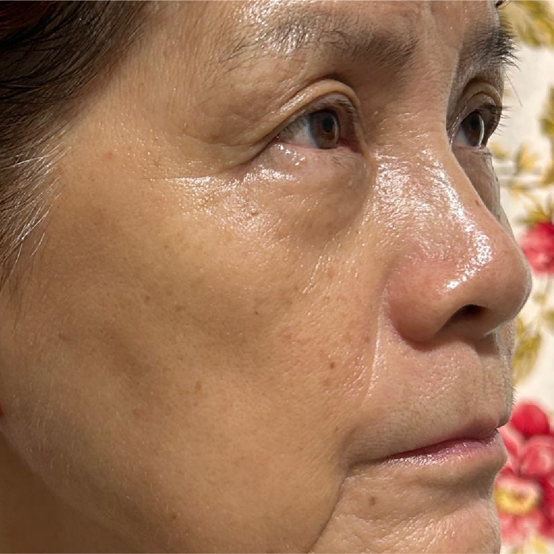 Ms Thean after 28 days of argan oil