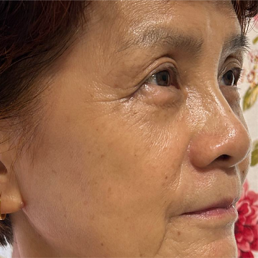 Ms Thean after one use of argan oil