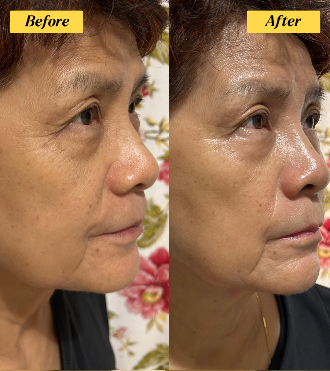 Ms Thean before and after 28 days of argan oil