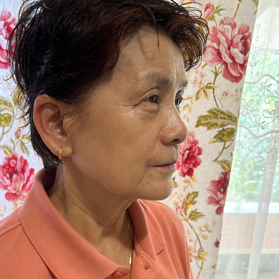 Ms Eng's face after one use, skin looking softer and smoother