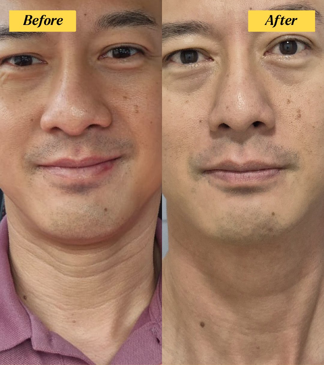 Jared before and after 28 days of argan oil