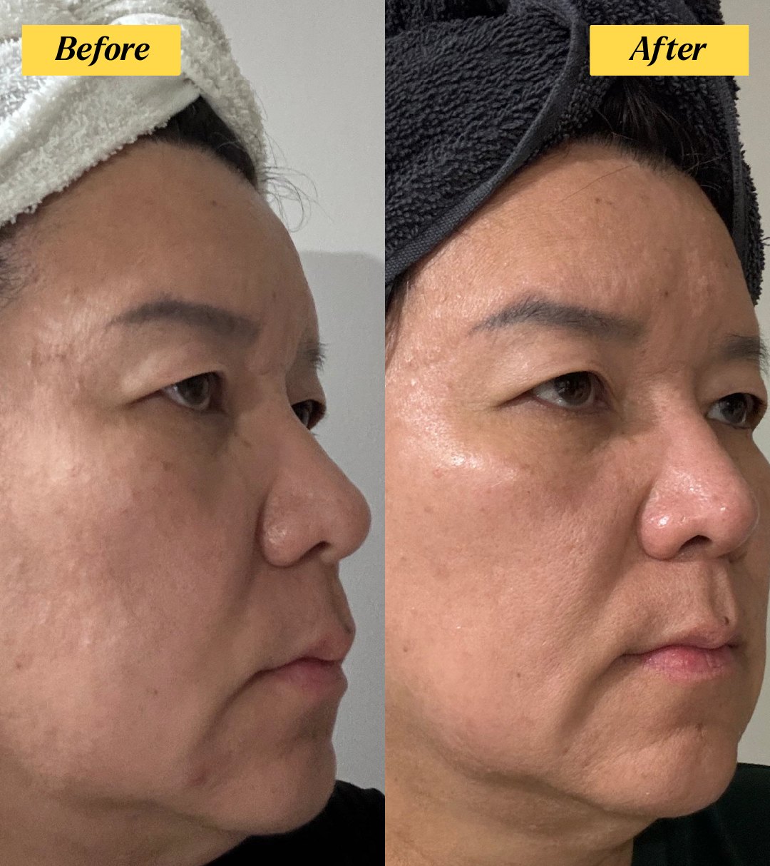 Ms Tan before and after 28 days of argan oil
